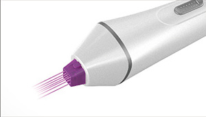 2023 Leaflife fractional plasma device MjoInir Series tips/plasma treatment blue & purple tips/single needle tips