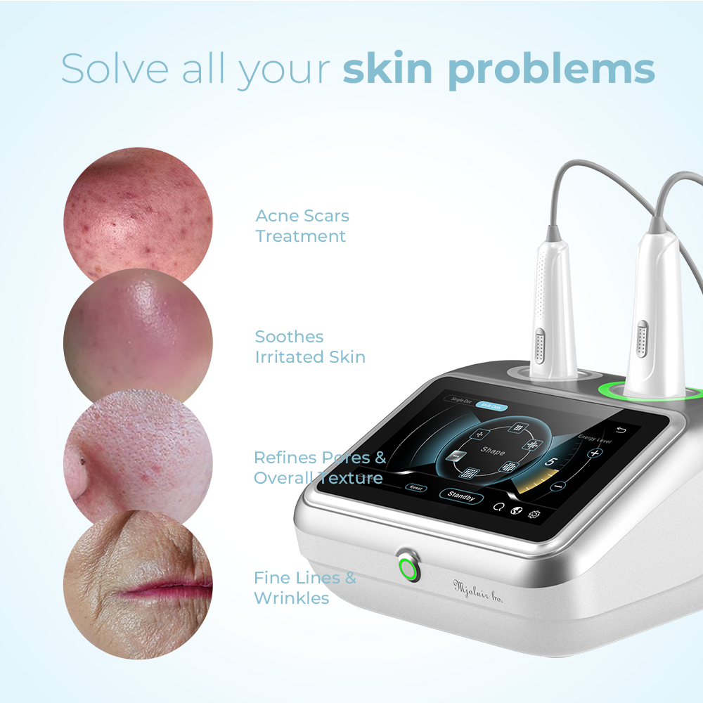 Leaflife fractional & cold jet plasma lift machine / NEW INNOVATIVE Technology Acne scars tag mole eyebag wrinkle removal device