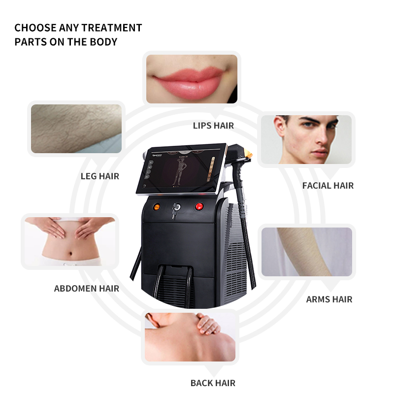 Permanent 3 Wavelengths 1600W 2400W 808 Diode Laser 755 808 1064 Diode Laser 808nm Hair Removal Laser