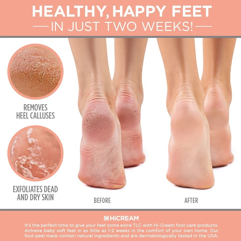 2024 Best Peach Exfoliating Foot Peel Mask Cracked Heels Repair Dead Skin & Calluses Removal Baby Soft Feet SPA Mask