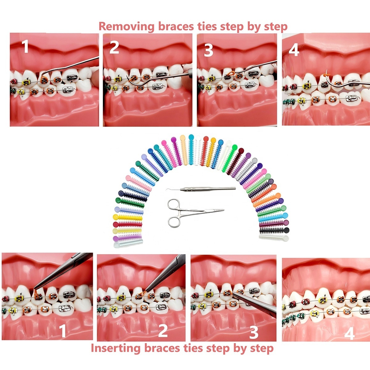 Dental Braces Color Changing Kit, Orthodontic Ties Changing kit