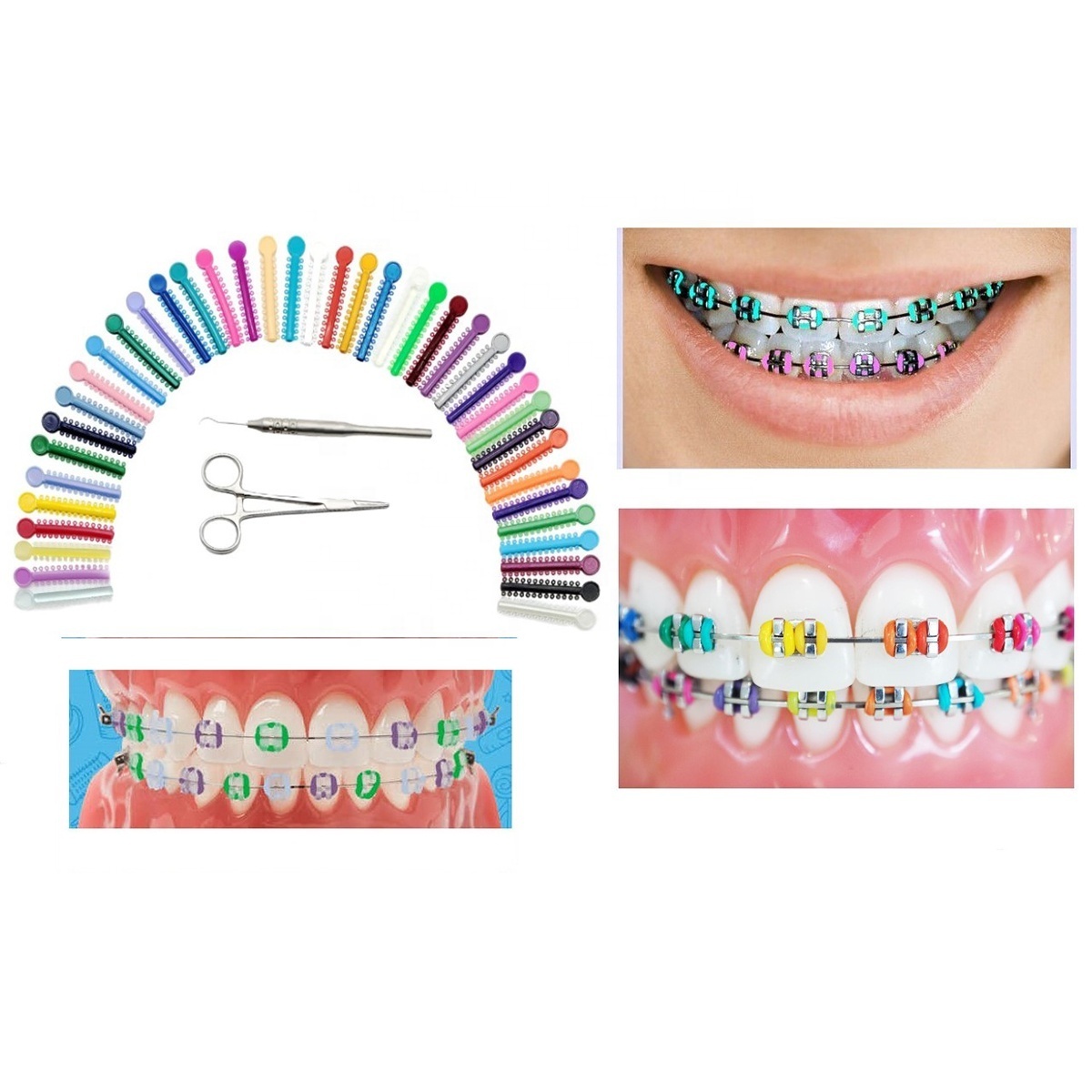 Dental Braces Color Changing Kit, Orthodontic Ties Changing kit