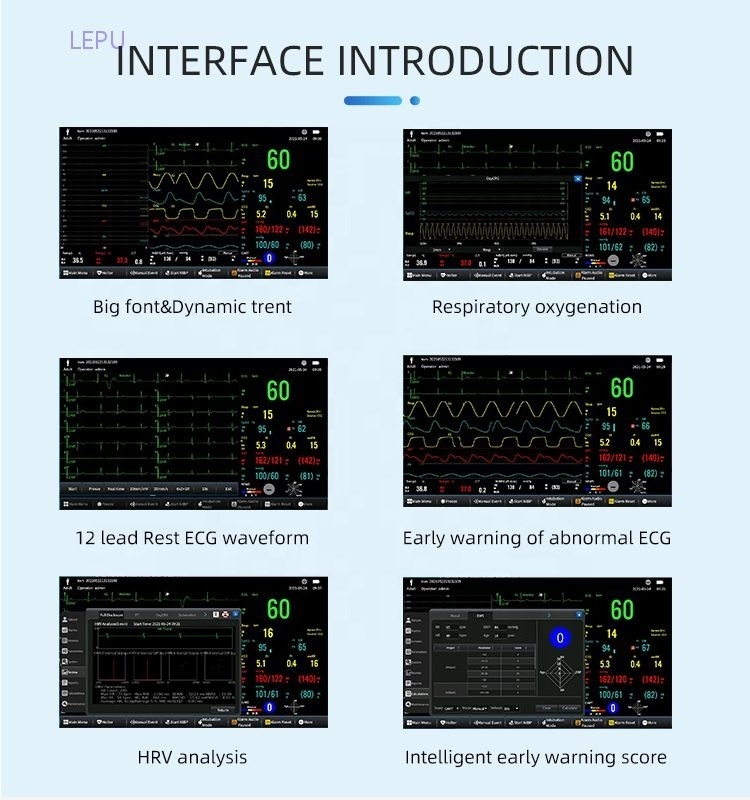 ICU monitor medical equipment New product 2021 Chinese hospital equipment vital signs portable multi-parameter patient monitor