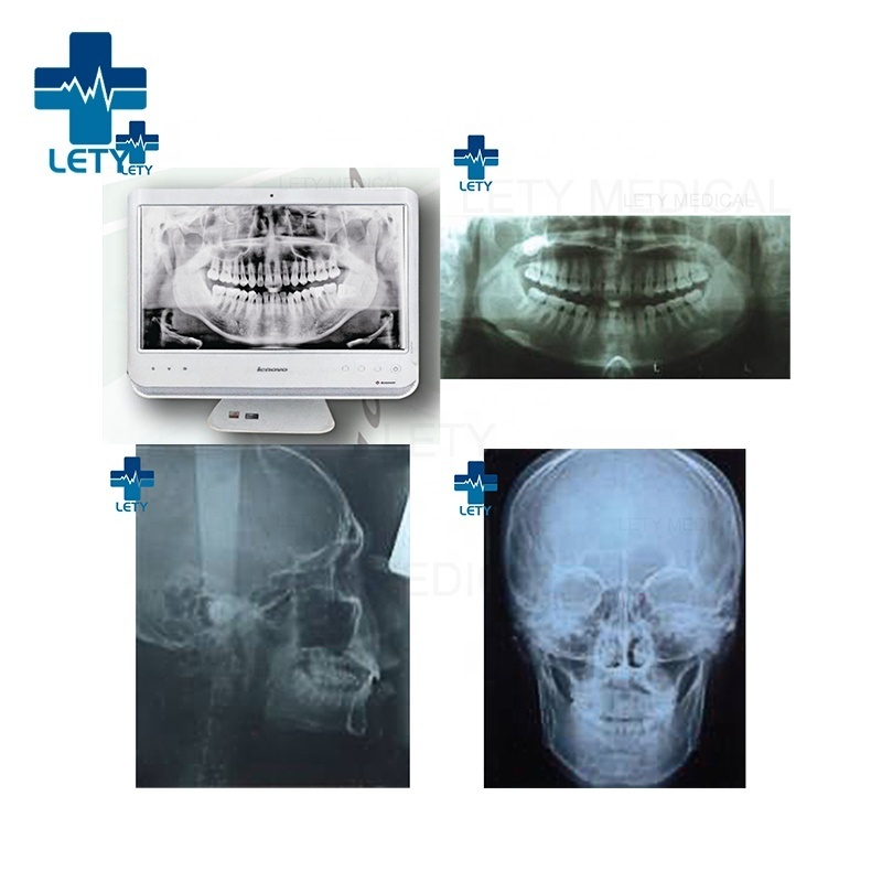 Digital Panoramic Dental X-ray Machine MCX-DP3 High Frequency Panoramic Dental X-ray machine