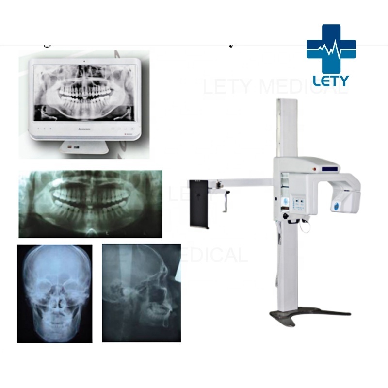 Digital Panoramic Dental X-ray Machine MCX-DP3 High Frequency Panoramic Dental X-ray machine