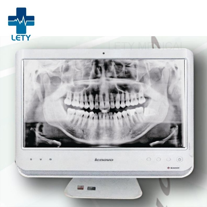 Digital Panoramic Dental X-ray Machine MCX-DP3 High Frequency Panoramic Dental X-ray machine