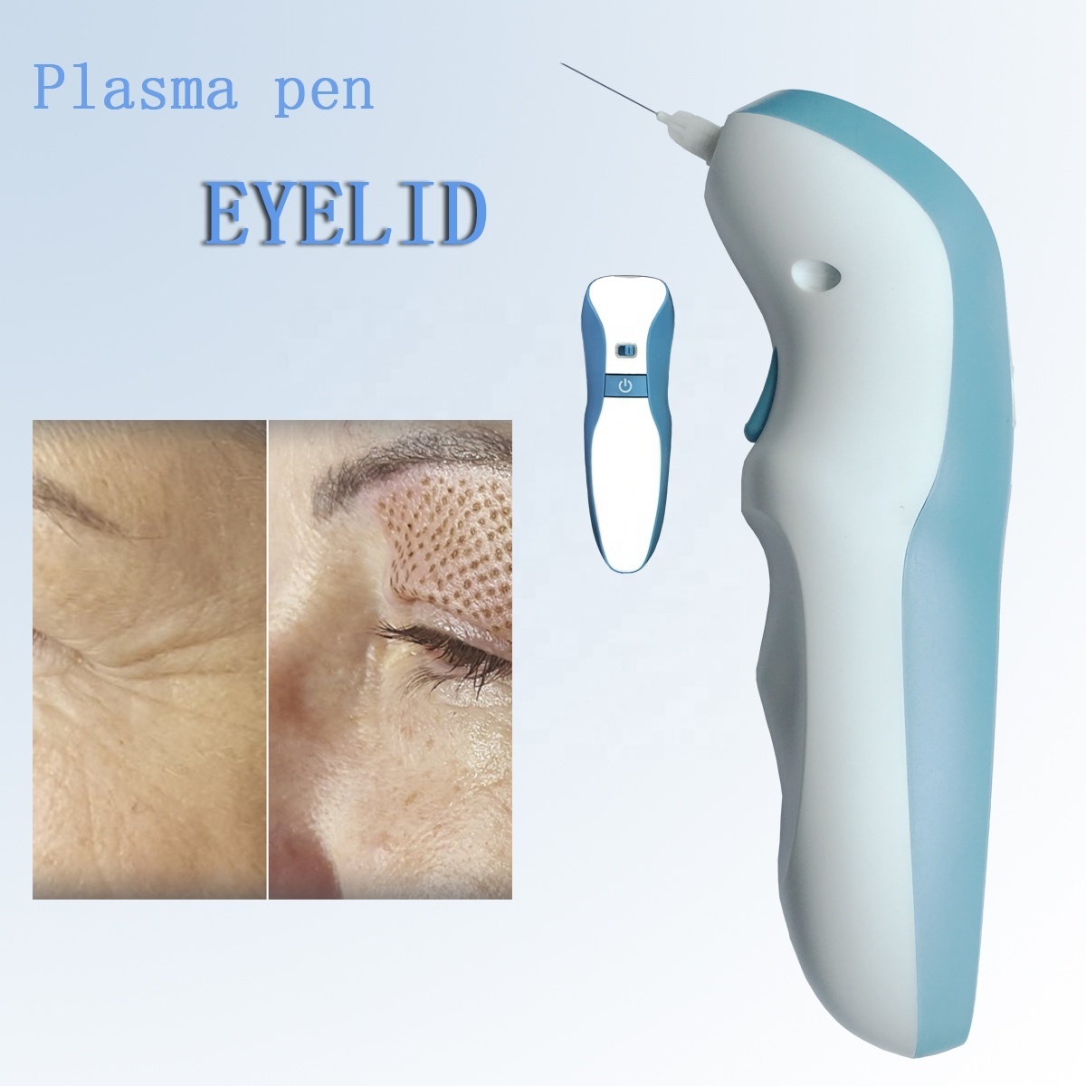 2018 New Product Dark Spot Freckle Mole Removal Eyelid lifting plasma pen for skin tightening