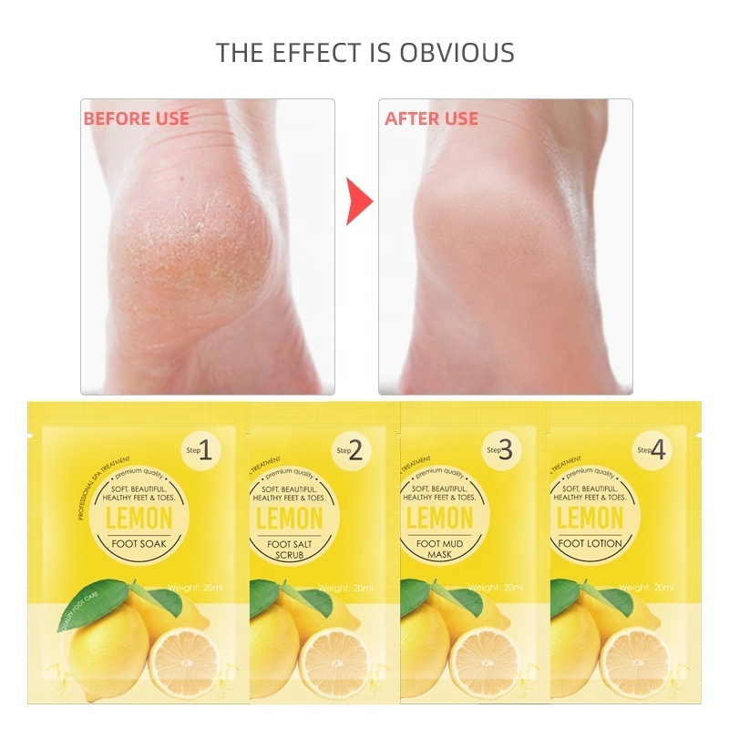 Private Label Natural Lemon Foot Skin Care Allur Jelly Pedicure Lotion Moist Smoothing 4 In 1 Step Pedicure Kit Foot Scrub