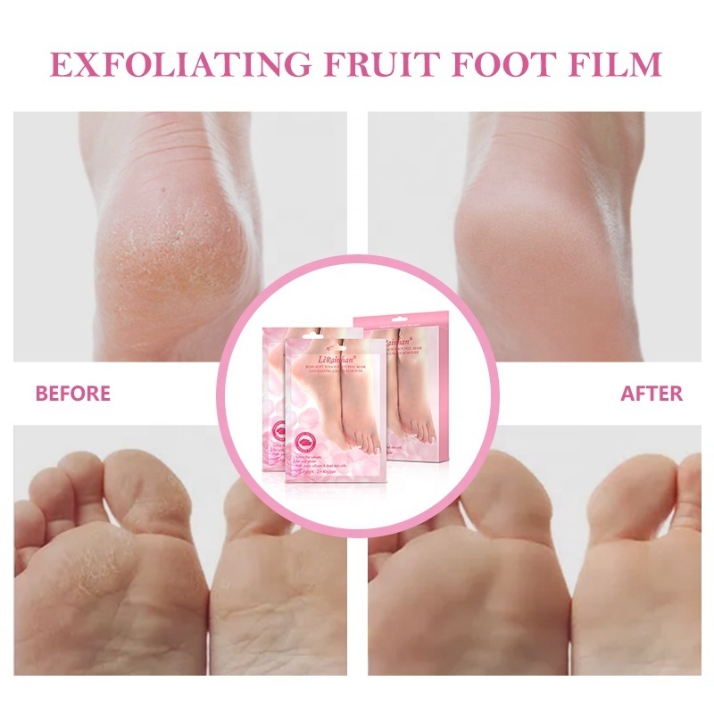 Custom OEM Korea Foot Peeling Pack Pink Rose Exfoliating Feet Peel Foot Exfoliation Peeling Mask Baby Your Foot Skin Care Mask