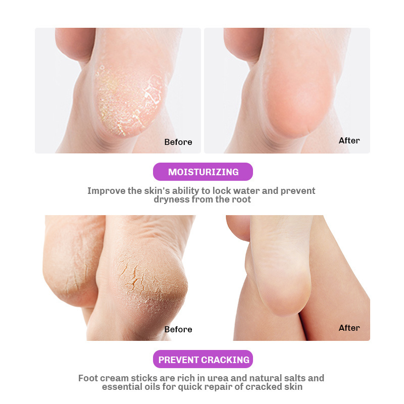 Foot Care Cream for Cracked Heels Exfoliating Anti Crack Peeling Dead Skin Removal Foot Repair Whitening Foot Cream