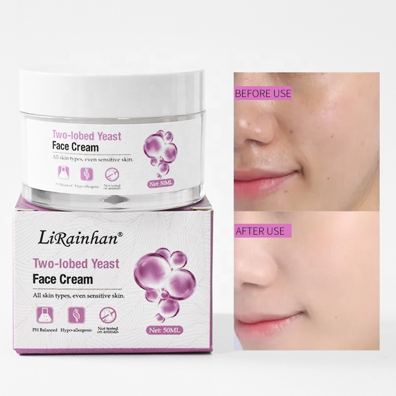 Private Label Organic Natural Bifida Ferment Extract Facial Cream Top Best Repair Whitening Moisturizing Face Cream