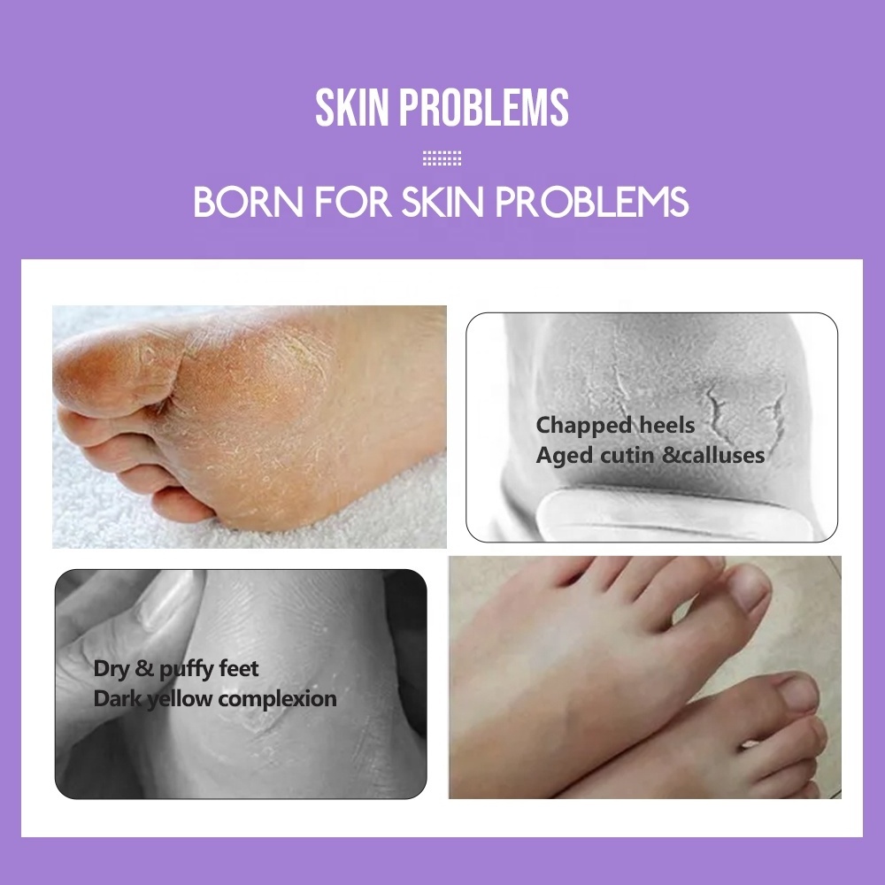 Custom Feet Skin Care Moisturizing Callus Remover Footmask Exfoliating Nourishing Socks Peeling Foot Mask