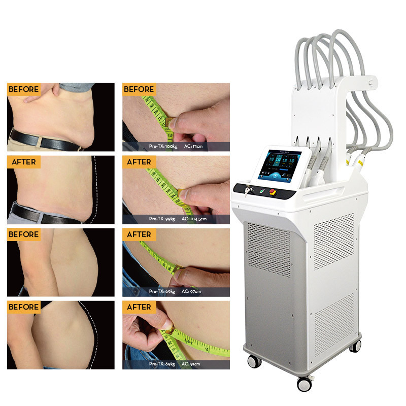 Factory Price Lipo Laser Machine Cavitation Maquina Machine Rf Fat Sculpting Weight Loss