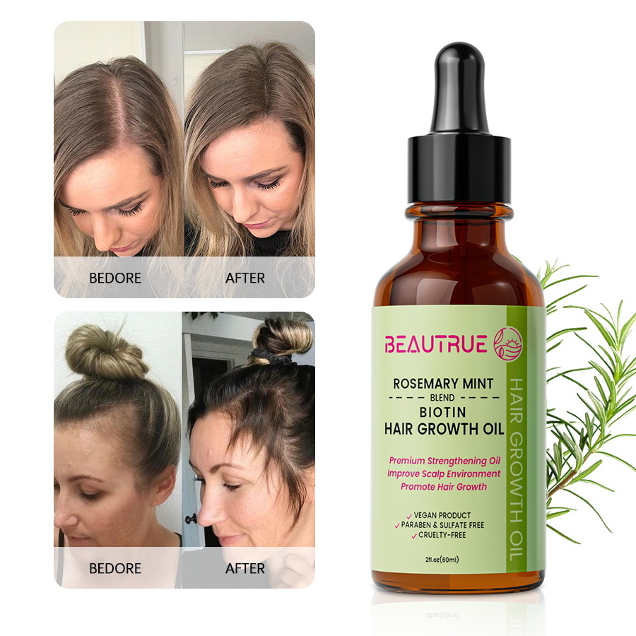 Hot Selling Promotion 60ml Natural Organic Rosemary Hair Growth Oil Private Label Scalp Treatment With Biotin Mint Growth Oil