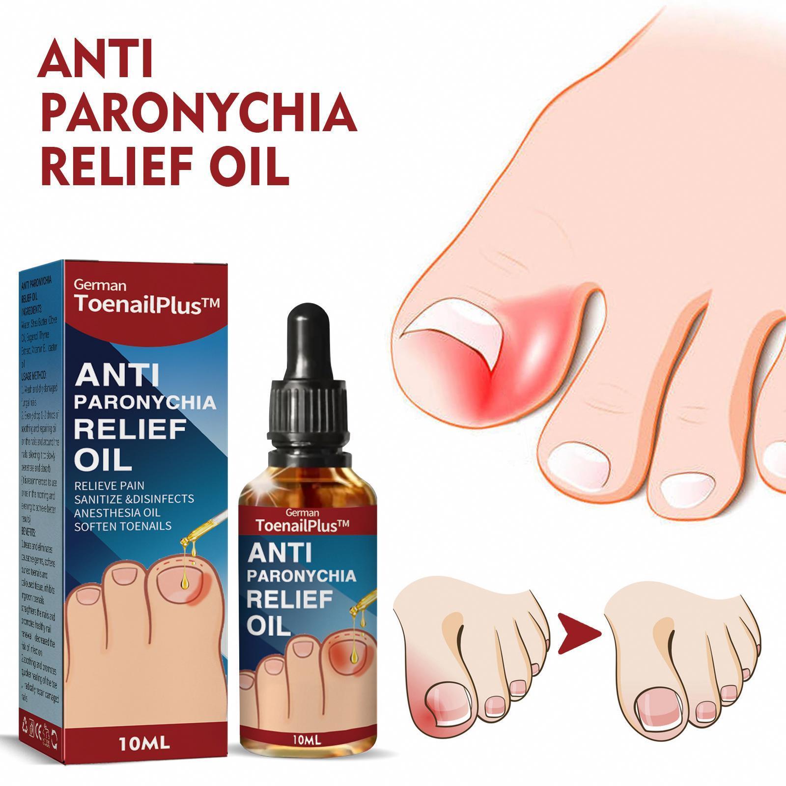 Soften Nail Anti Podiatry Paronychia Correction Professional Suppliers Relief Oil Repair Grey Hand Toenail Ingrown Essential Oil