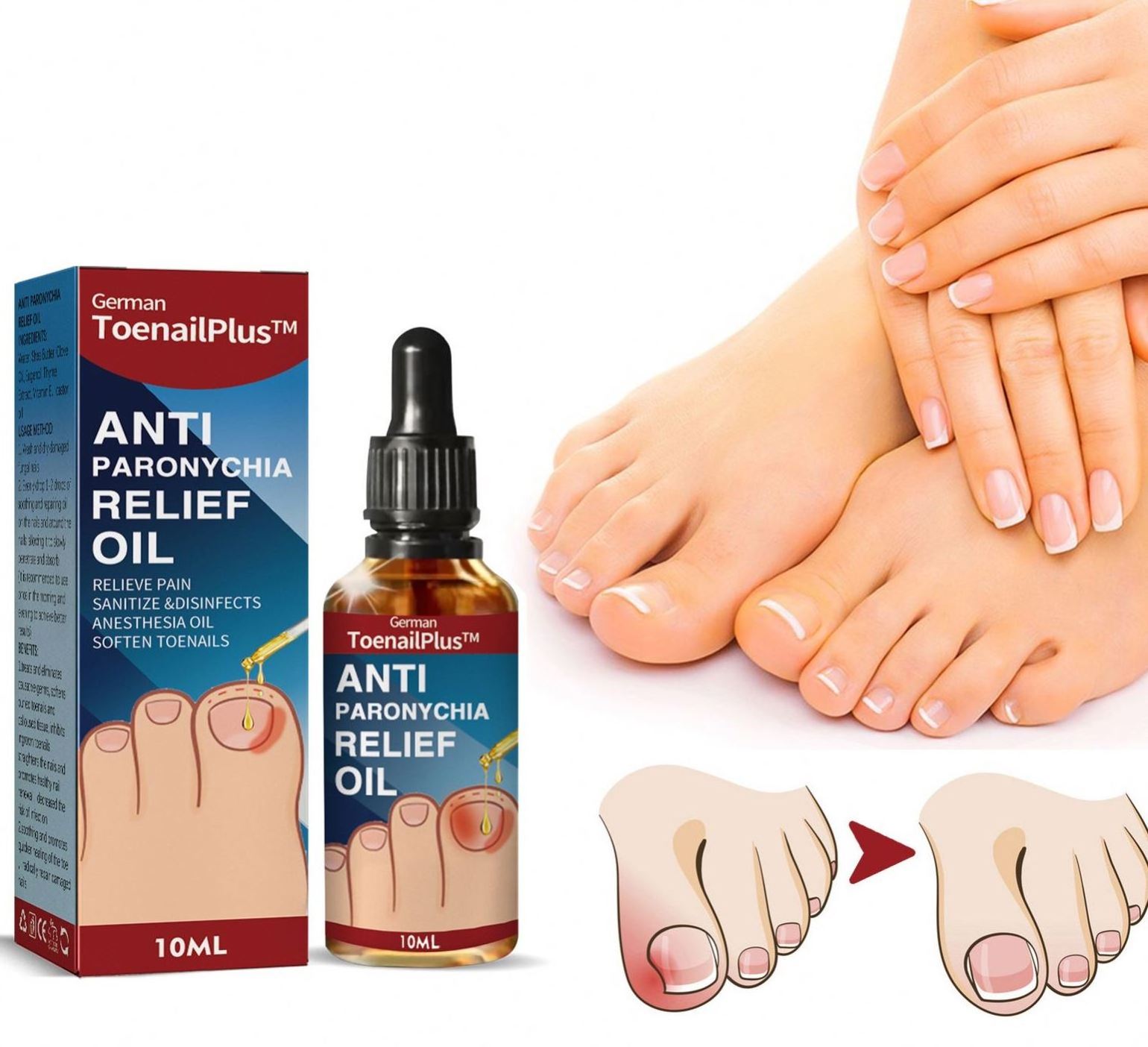 Soften Nail Anti Podiatry Paronychia Correction Professional Suppliers Relief Oil Repair Grey Hand Toenail Ingrown Essential Oil