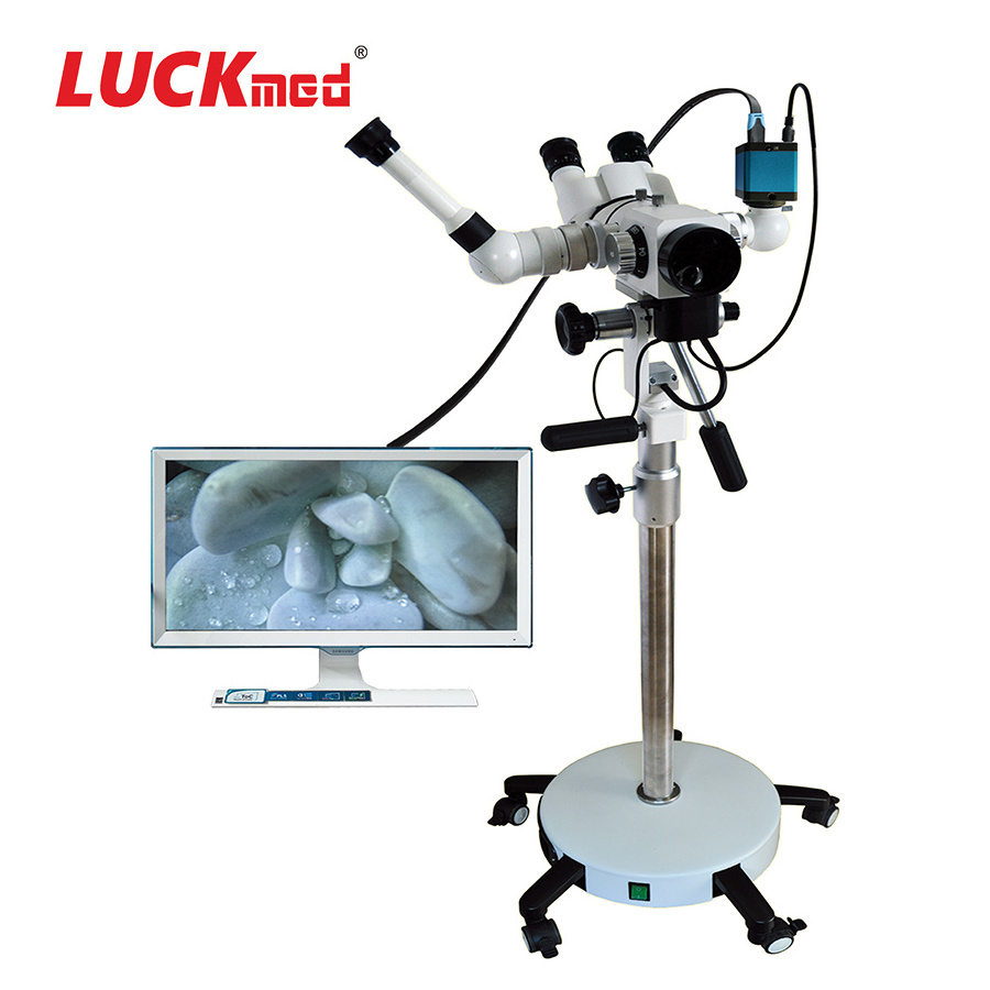 Medical Digital Gynecologic Examination Colposcope HD Video Vaginal Camera for Gynecology Vagina Endoscope