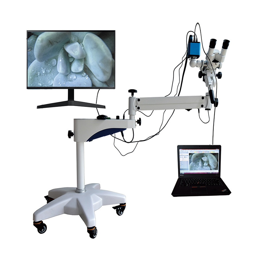 Medical Digital Gynecologic Examination Colposcope HD Video Vaginal Camera for Gynecology Vagina Endoscope