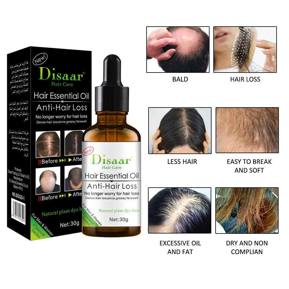 Private label hair care product natural plant hair essential oil massage anti hair loss women men treatment growth oil