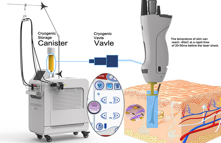 Factory price alexandrite Laser 755nm Depilator hair removal machine