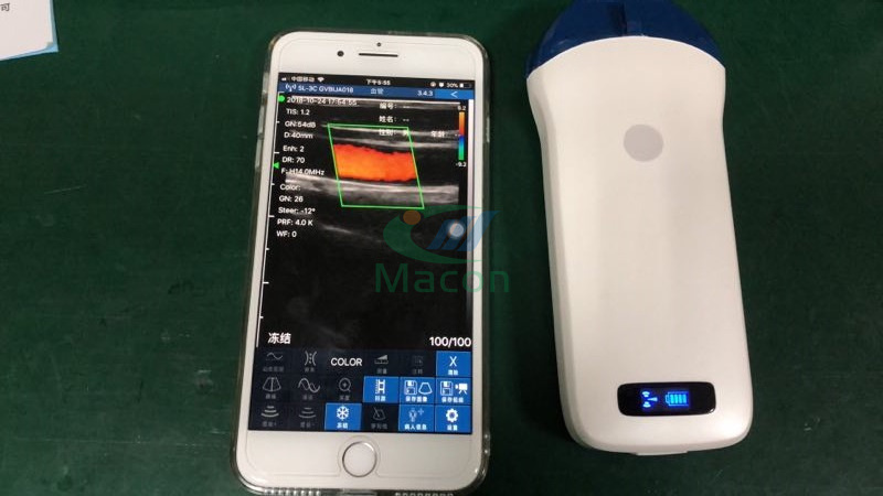 MC14 Very good choice high frequency 10/14Mhz linear wireless ultrasound probe for PICC puncture injection and MSK