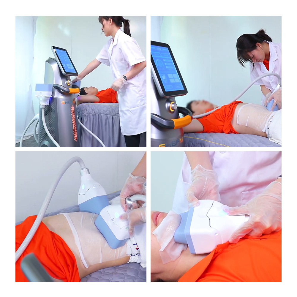 Portable crypolysis cool tech pdt fat freezing machine 360 skin tightening / liposuction machine