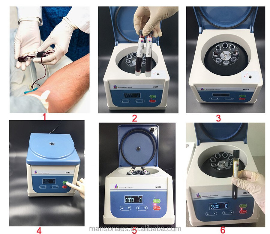 Blood Plasma Extractor PRP Dental Lab PRF Centrifuge machine