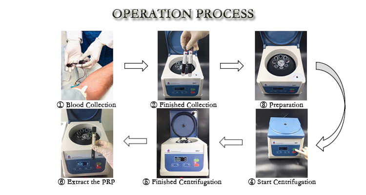 MANSON Blood Plasma Extractor PRP Micro Centrifuge Machine