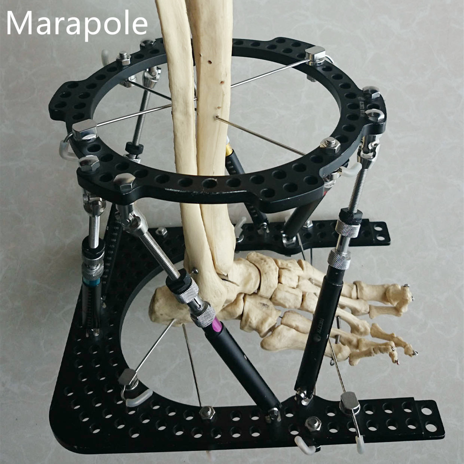 Orthopedic Instruments Ilizarov/Hoffman/Taylor/Peek RadioLucent external fixator,Bone Lengthening External