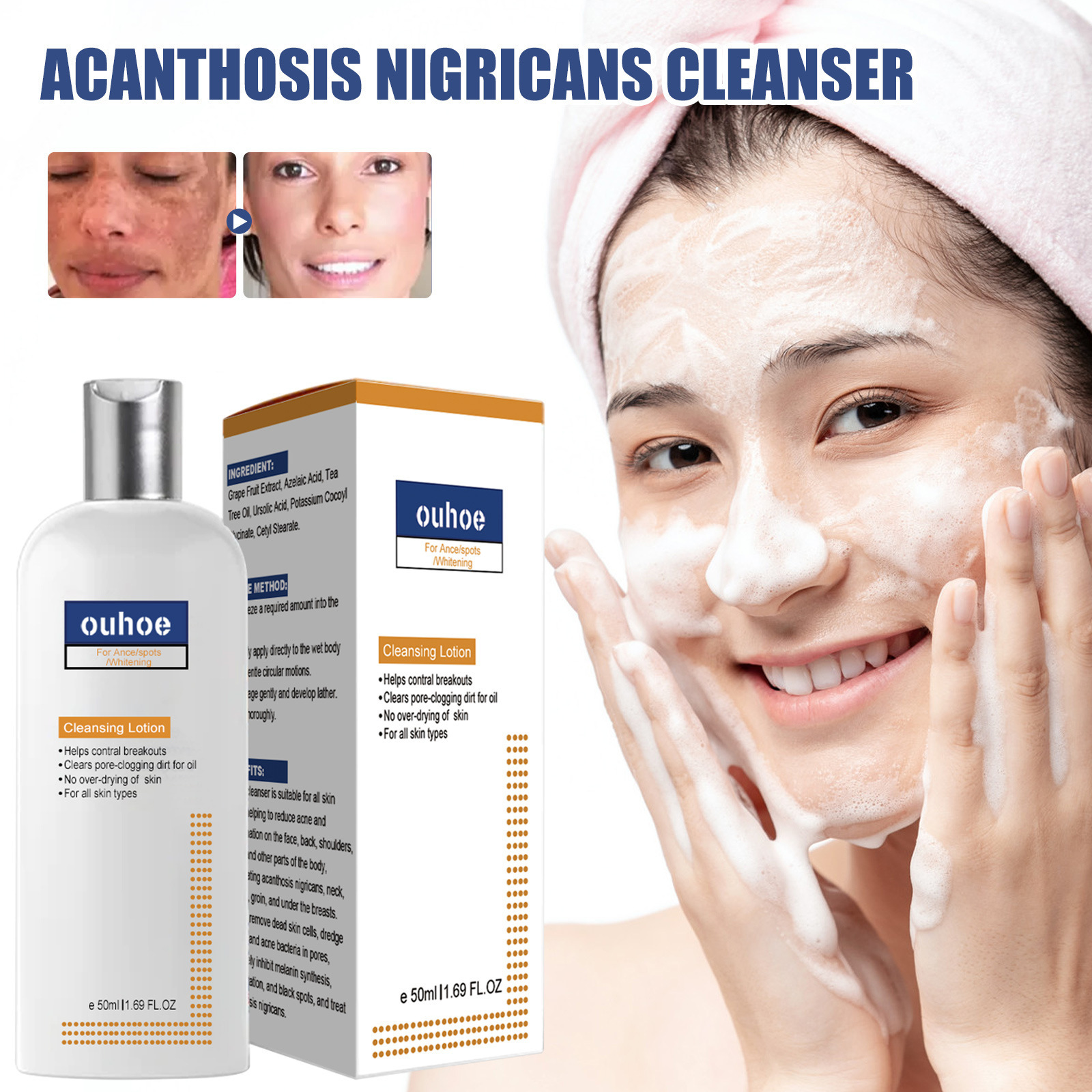 Lightening Dark Face Whitening Deep Cleansing Soft Moisturizing Skin Repair Cleanser Acanthoderm Black Skin Cleanser