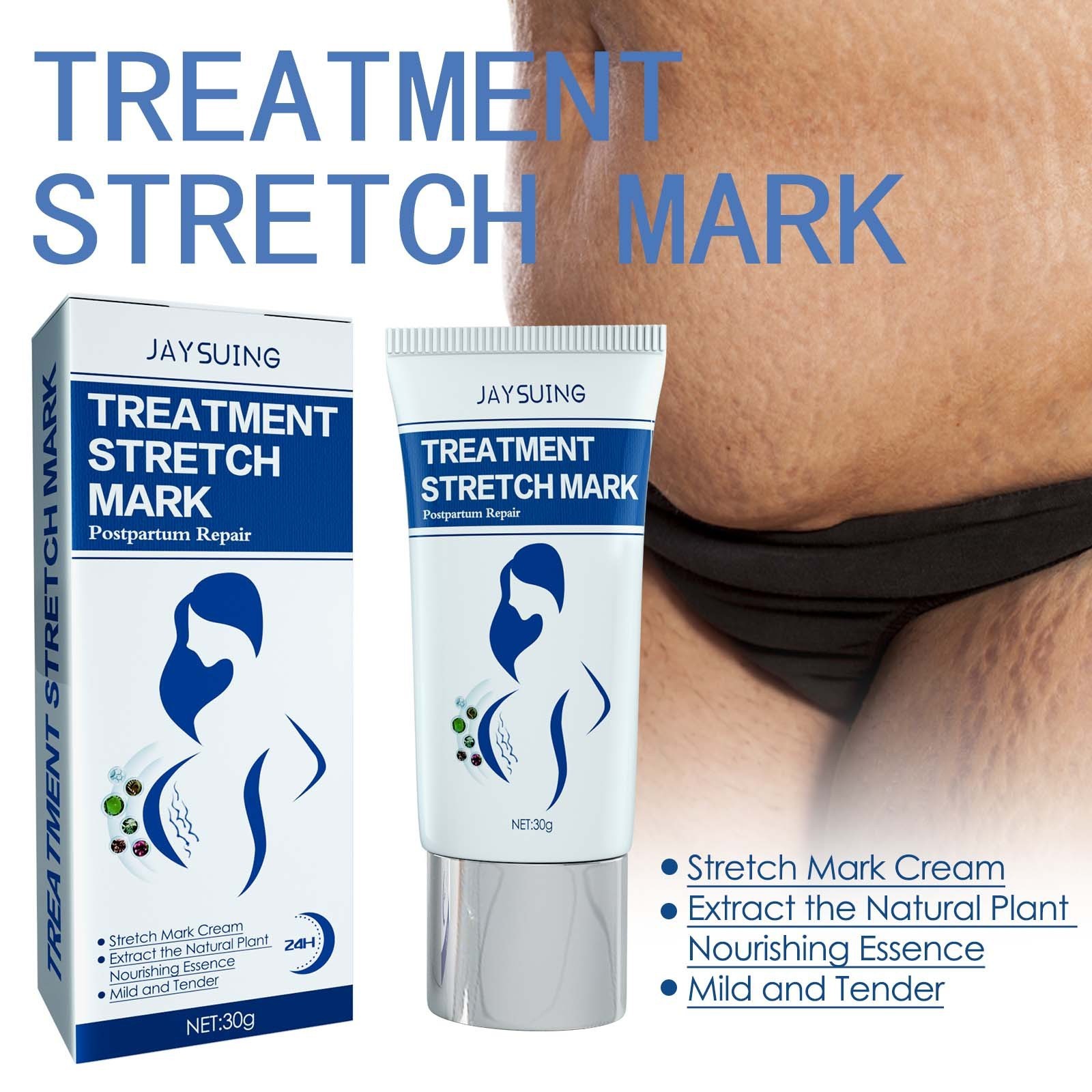 Jaysuing OEM ODM Pregnancy Marks Removal Body Stretch Mark Cream For Legs