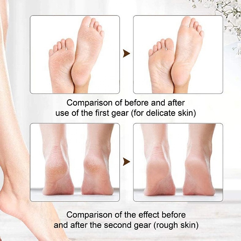 professional pedicure care machine cordless foot grinder waterproof foot file electric feet callus remover with LED light