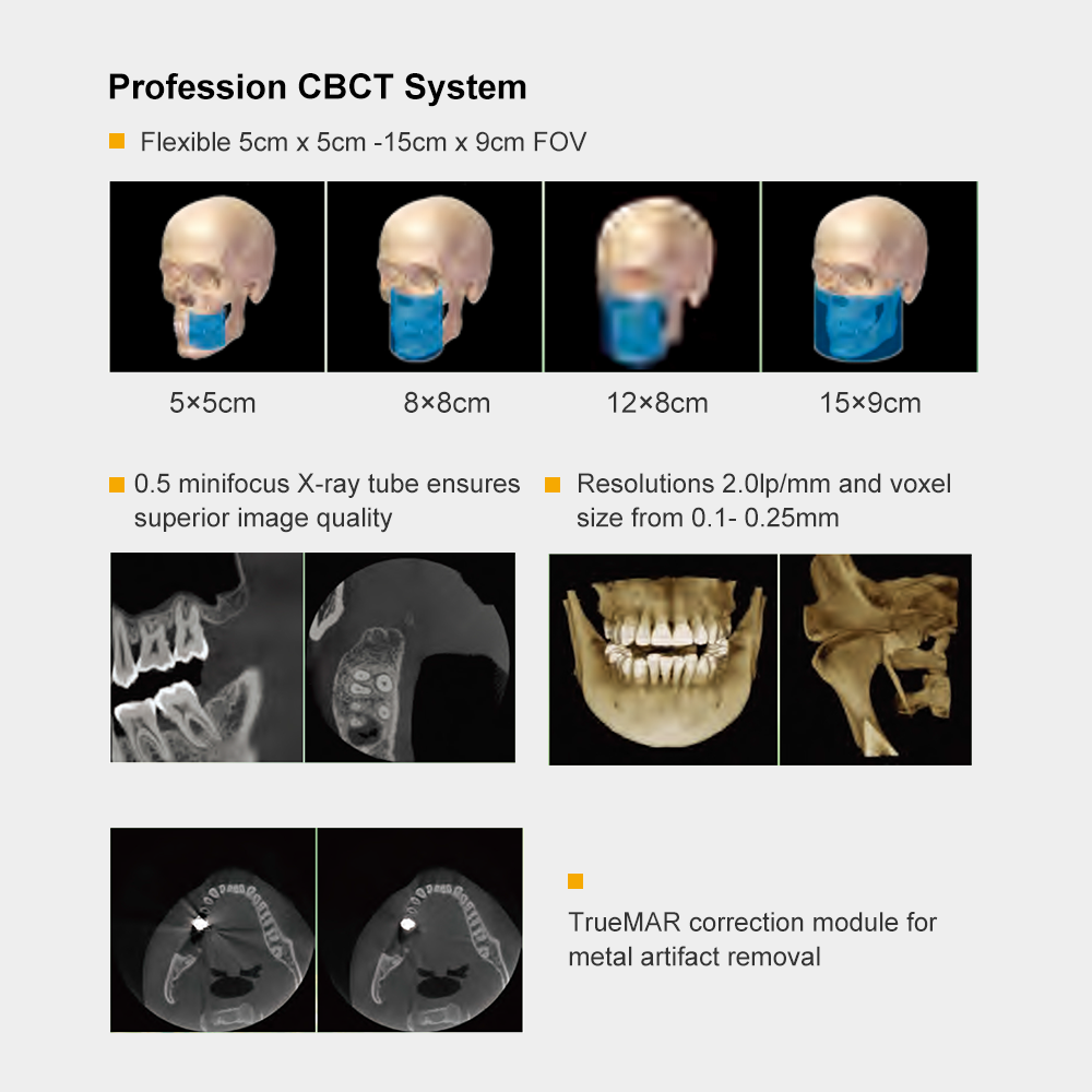 3D Digital Rayos X Periapical Cephalometric Panorama xray panoramic dental x ray machine factory price