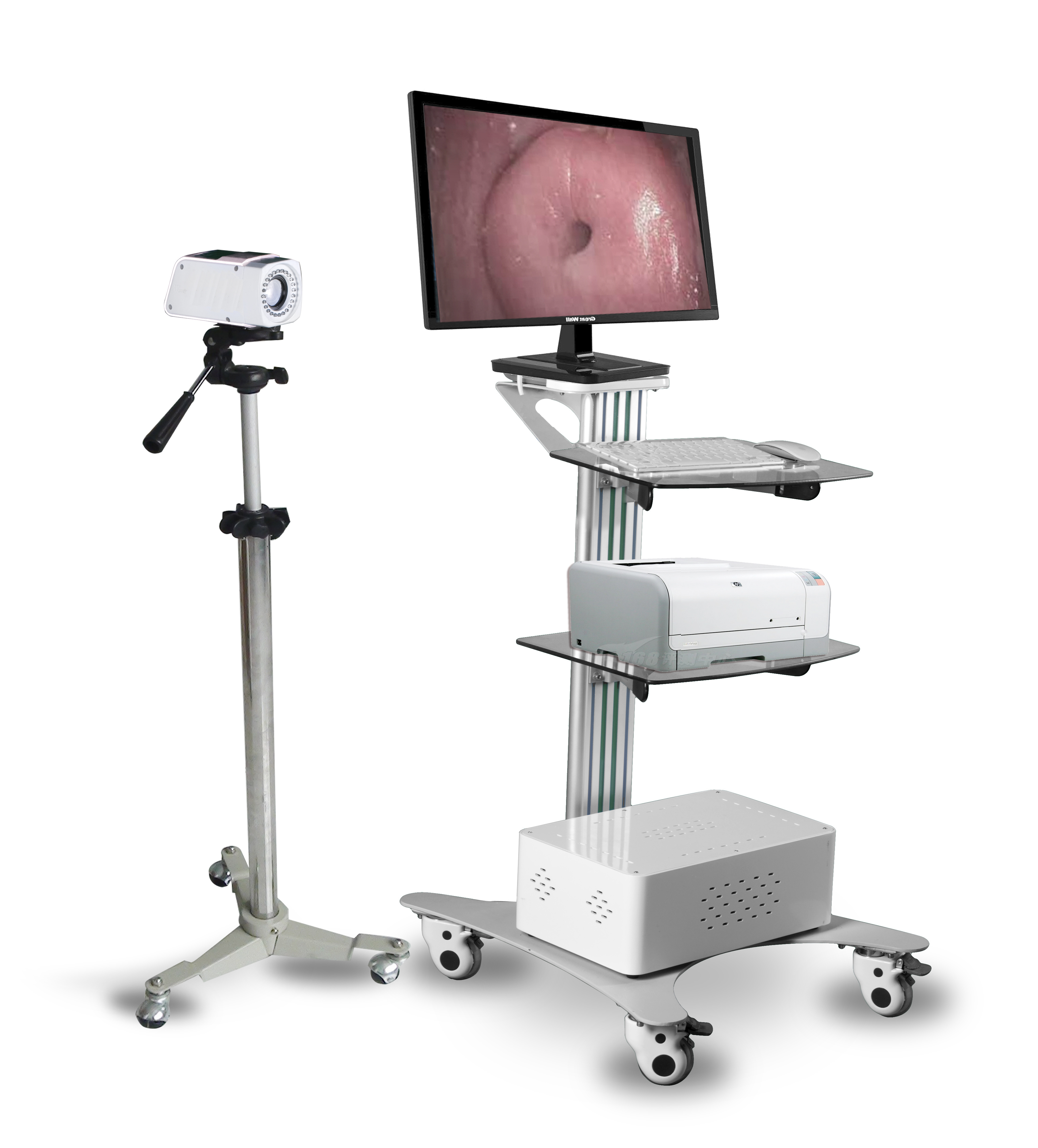 MAYA Digital Colposcope Device HD Video Vaginal Colposcope Camera For Gynecology