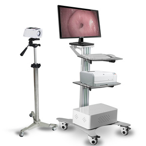 MAYA Digital Colposcope Device HD Video Vaginal Colposcope Camera For Gynecology