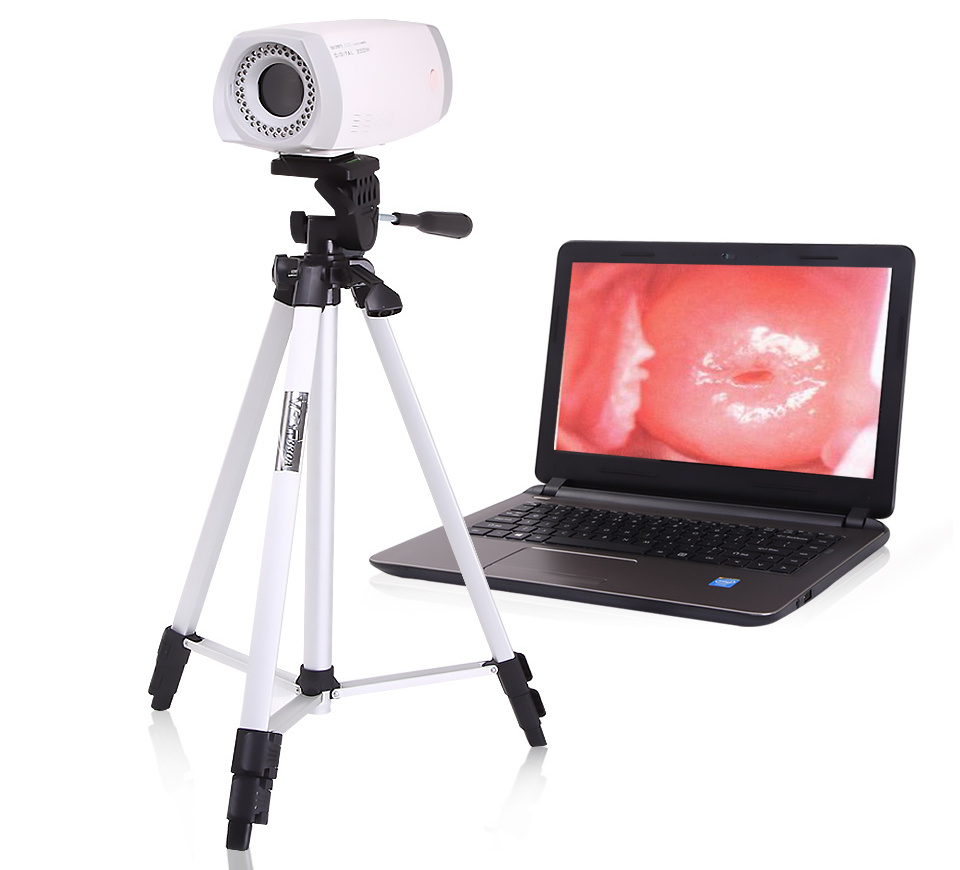 MAYA Digital Colposcope Device HD Video Vaginal Colposcope Camera For Gynecology