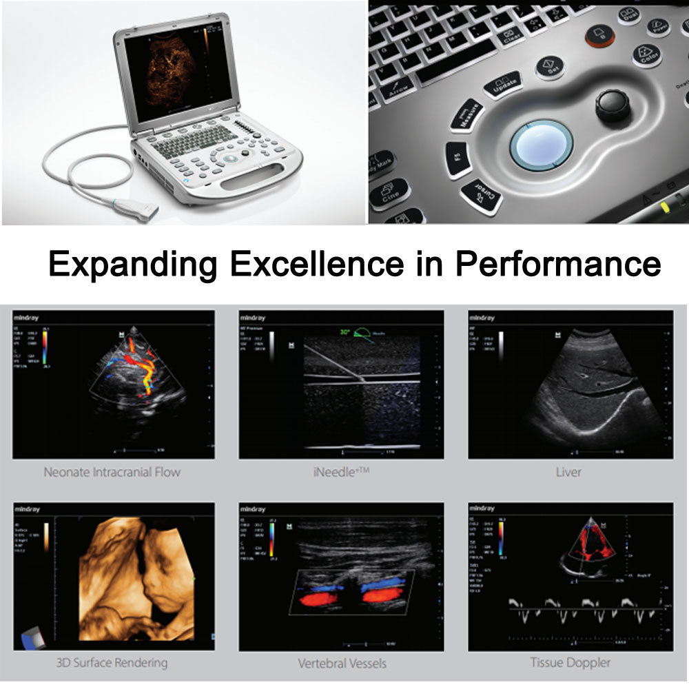 mindray m7 ultrasound Scanner Price Medical Ultrasound Instruments B/W Portable Ultrasound Machine