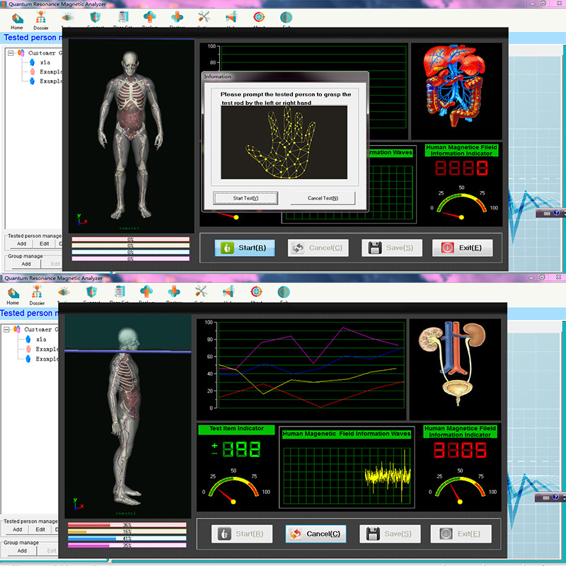 MY-S052J Portable Health Body Scanner Machine Sixth Generation Quantum Weak Magnetic Field Resonance Analyzer Machine