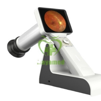 MY-V038 Hand-held Digital Eye Fundus Camera