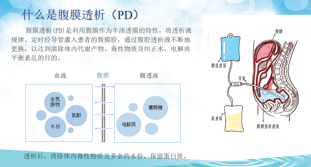 MY-O003A Hospital Medical Crrt Peritoneal Portable Kidney Hemodialysis Home Dialysis Machine Prices