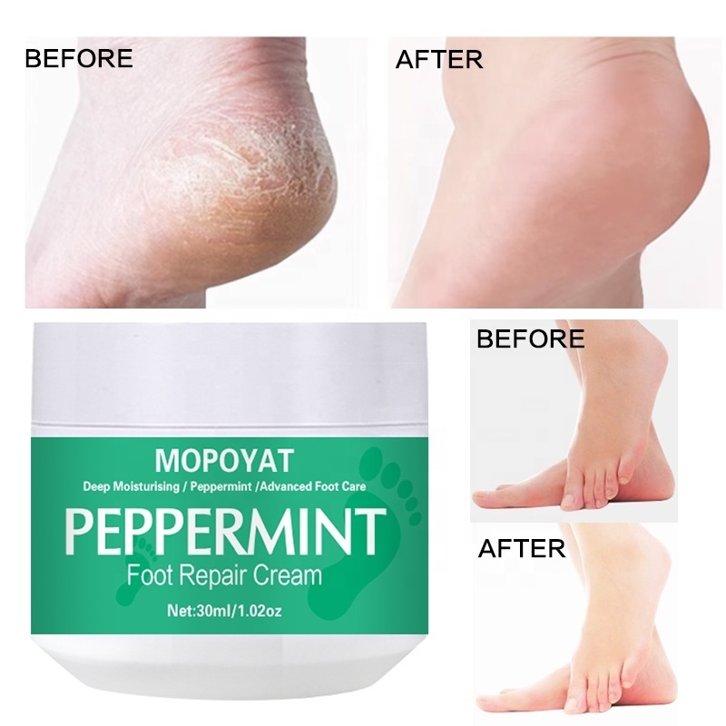 MOPOYAT Peppermint Foot Cream for Dry Cracked Heels Feet Knees Elbows Hands, Foot Dead Skin Cuticle Callus