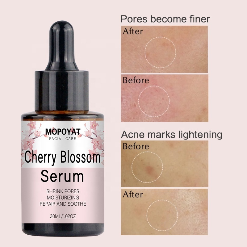 MOPOYAT Wholesale Sakura Face Serum Moisturizing Skin Shining with Hyaluronic Acid Serum for Shrinking Pores Tightening Skin