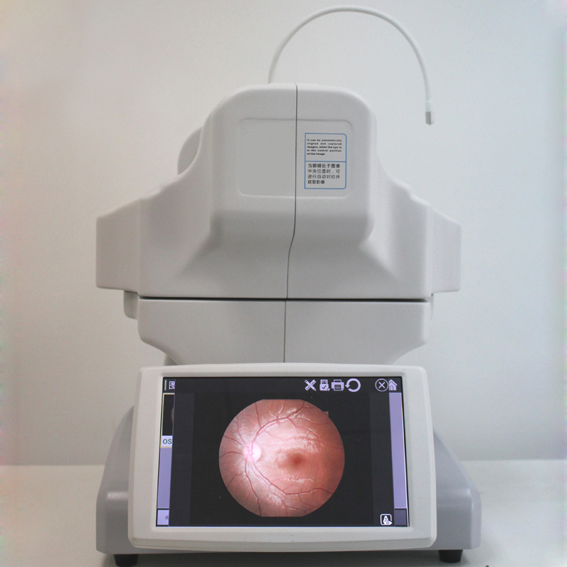 Non-mydriatic Automated Fundus Camera With Fluorescein Angiography