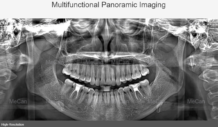 Panoramic X Ray Machine 3D Dental Panoramic X-ray Machine CBCT Dental X Ray