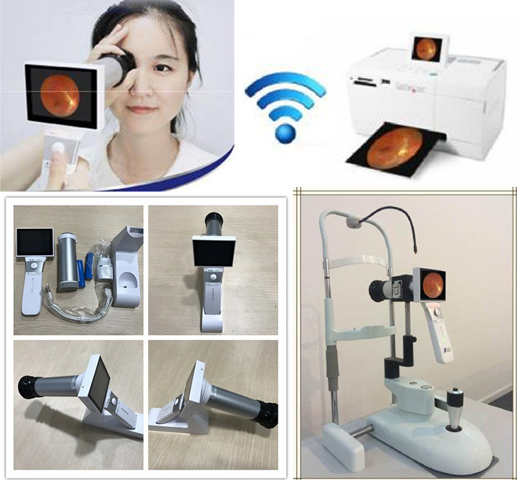 Medical Handheld Fundus Camera Ophthalmic Equipment Ultra Wide Field Eye Portable Hand Held Fundus Camera