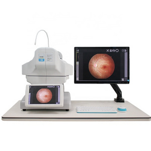 Non-mydriatic Automated Fundus Camera With Fluorescein Angiography