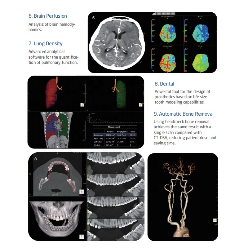 Hospital Radiology Computed Tomography Equipment 16 128 Slice CT Scanner Machine Price Medical 64 Slice CT Scan Machine