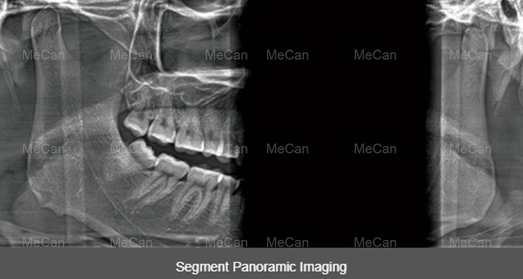 Panoramic X Ray Machine 3D Dental Panoramic X-ray Machine CBCT Dental X Ray