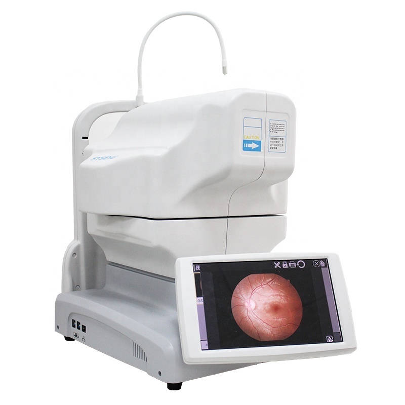 Non-mydriatic Automated Fundus Camera With Fluorescein Angiography