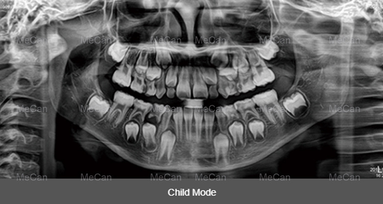 Panoramic X Ray Machine 3D Dental Panoramic X-ray Machine CBCT Dental X Ray